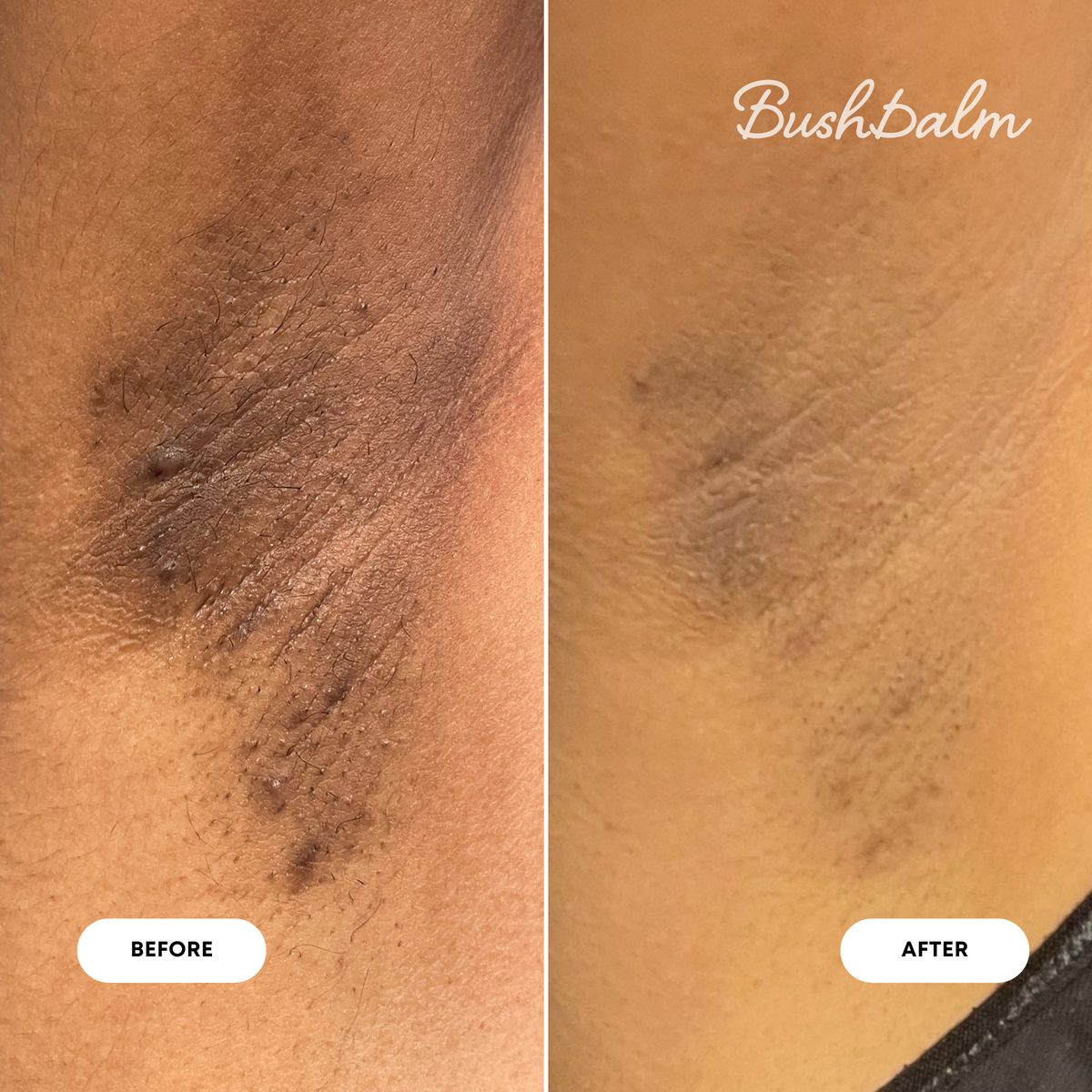 2-Step Dark Spot Routine - Bermuda D4