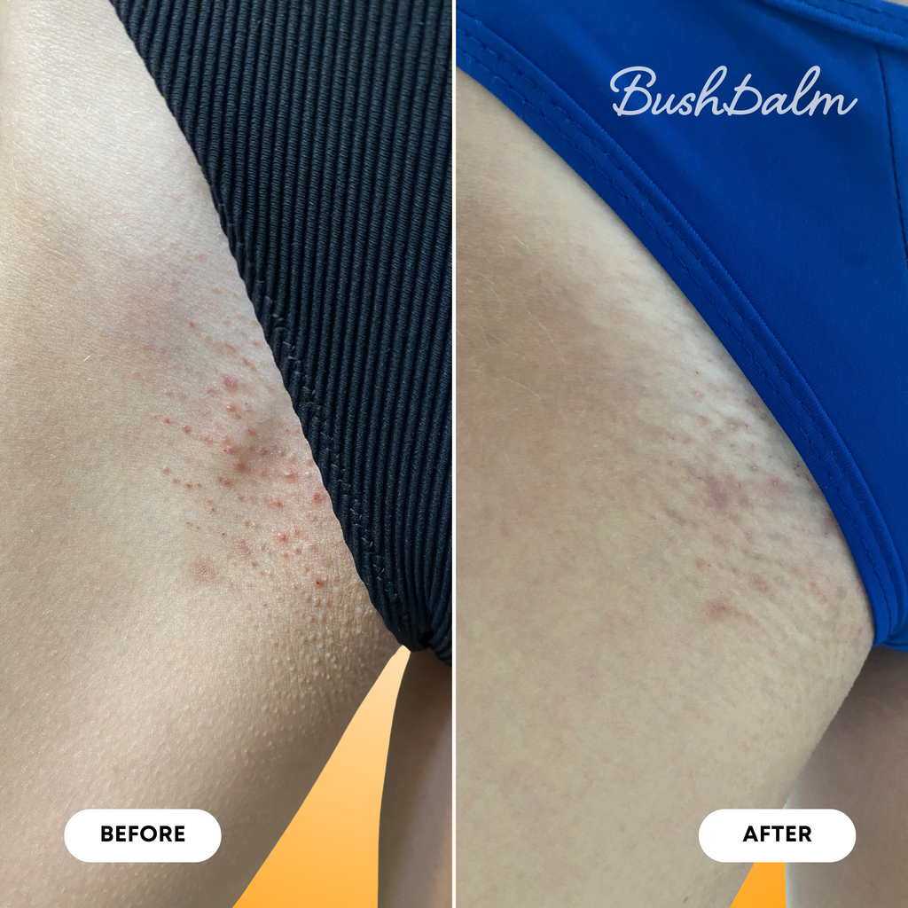 2-Step Ingrown Hair Routine - Vanilla Tangerine X7