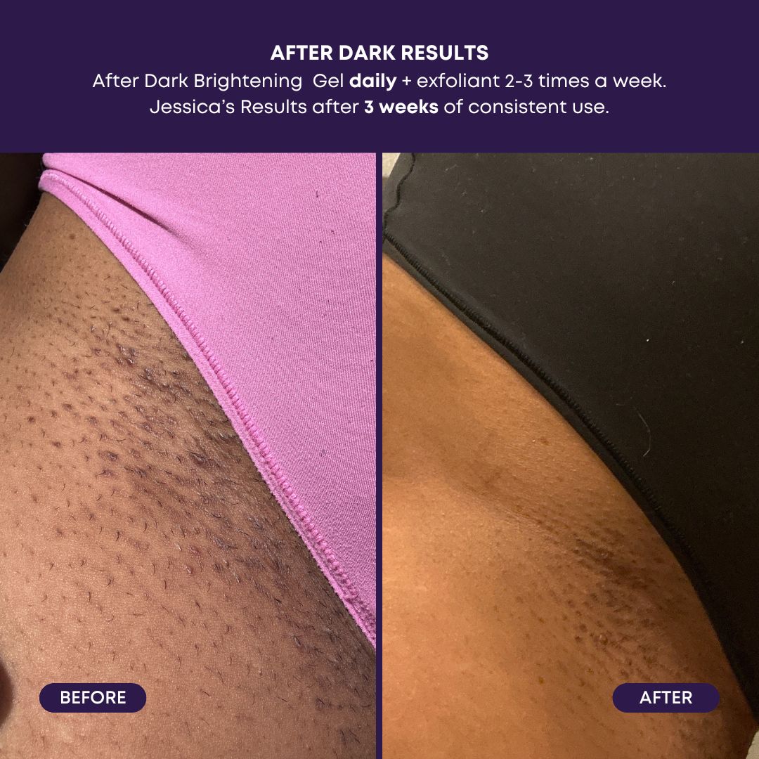 After Dark Brightening Gel R4
