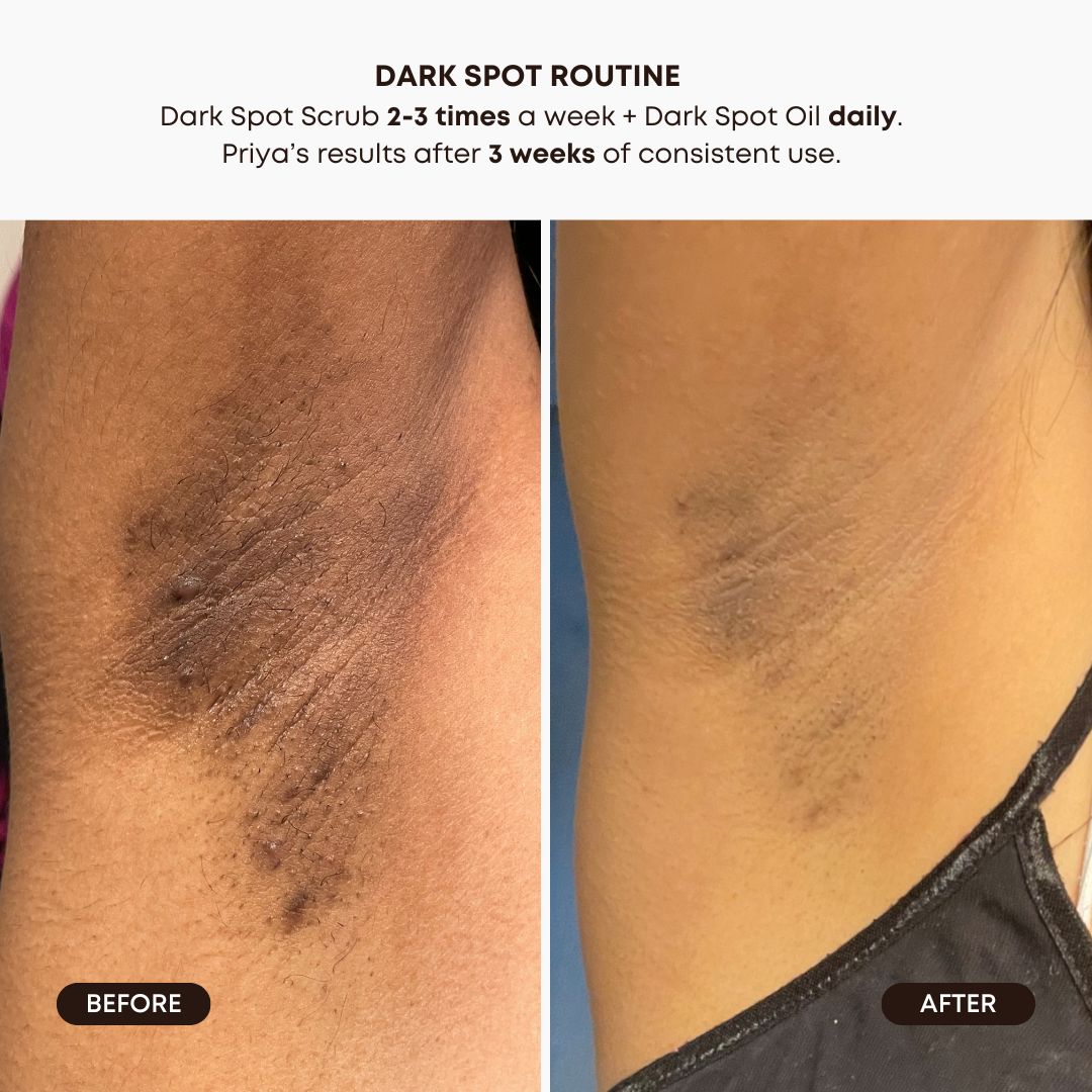 Dark Spot 2 Step Routine - Lavender Lemon N9