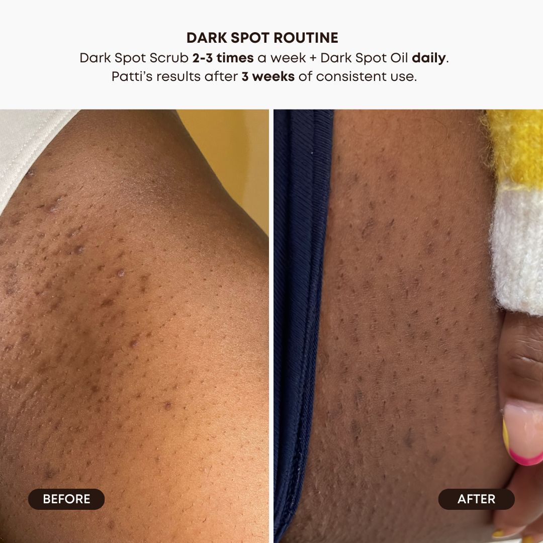 Dark Spot 2 Step Routine - Lavender Lemon N9