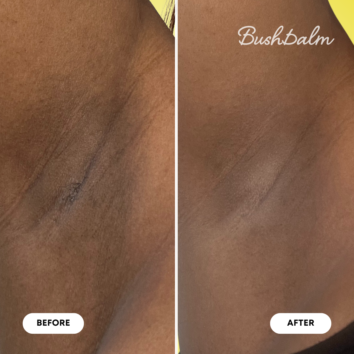 Dark Spot Exfoliating Scrub - Bermuda V4