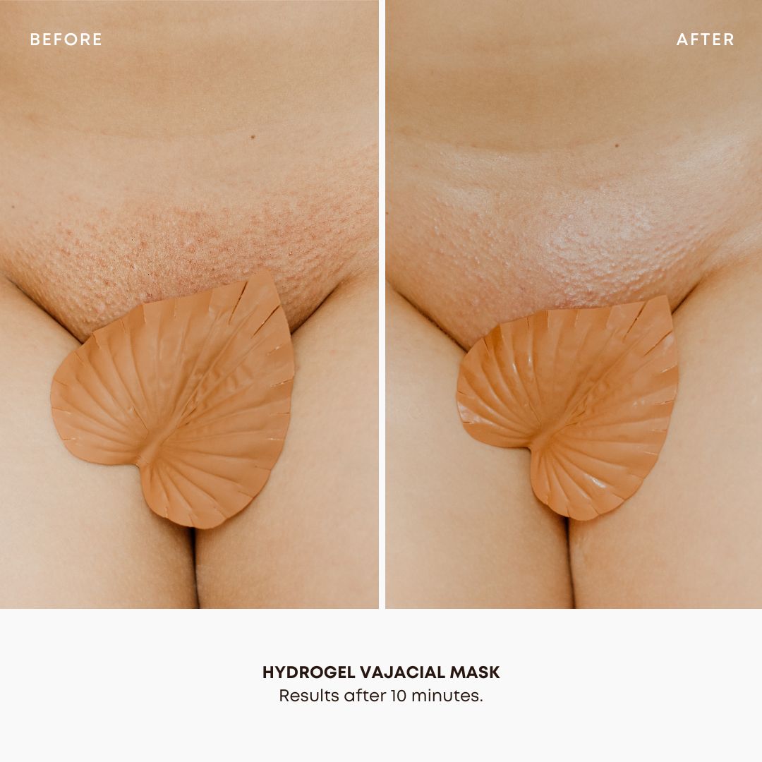 Hydrogel Vajacial Triangle Mask S2