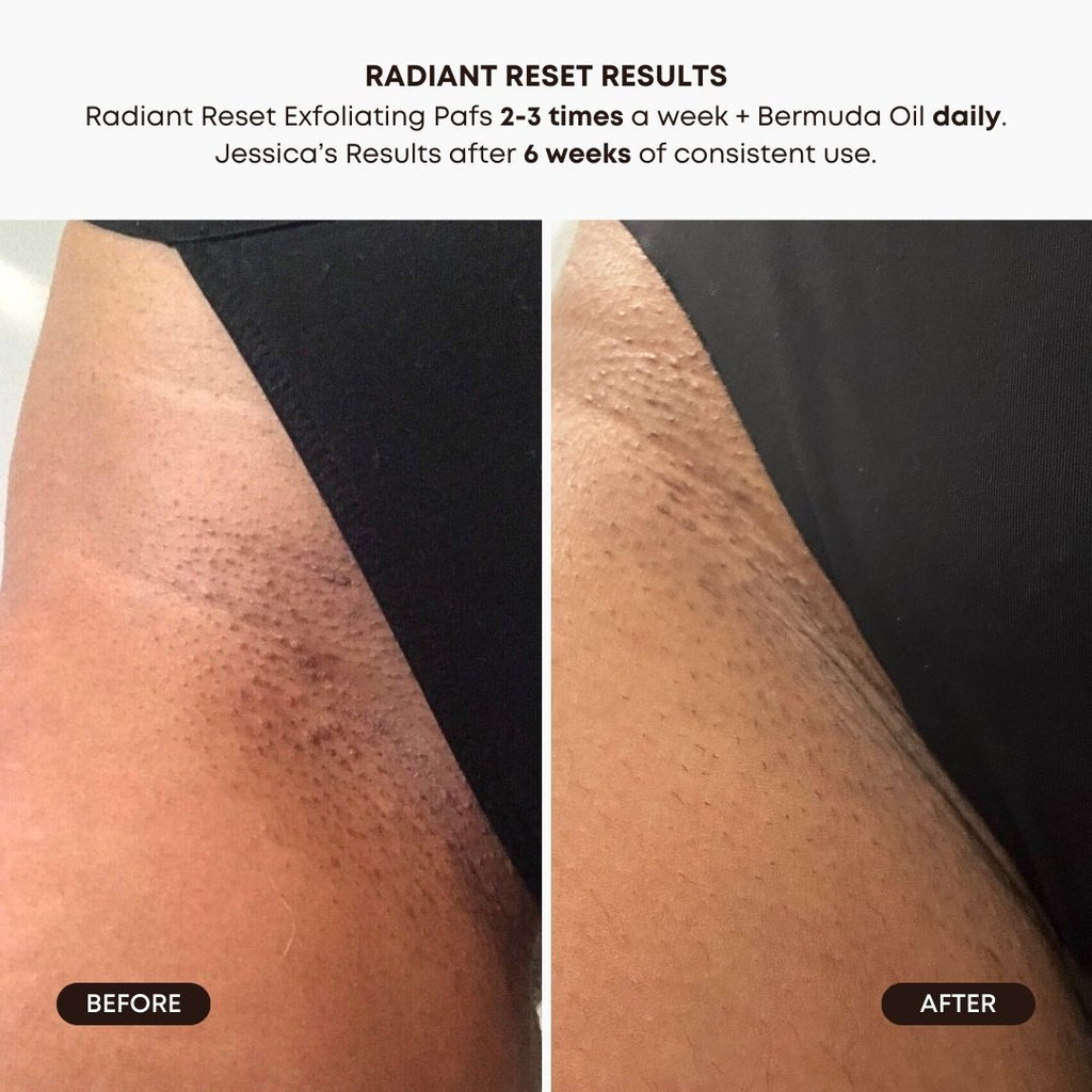 Radiant Reset Exfoliating Toner Pads Y1