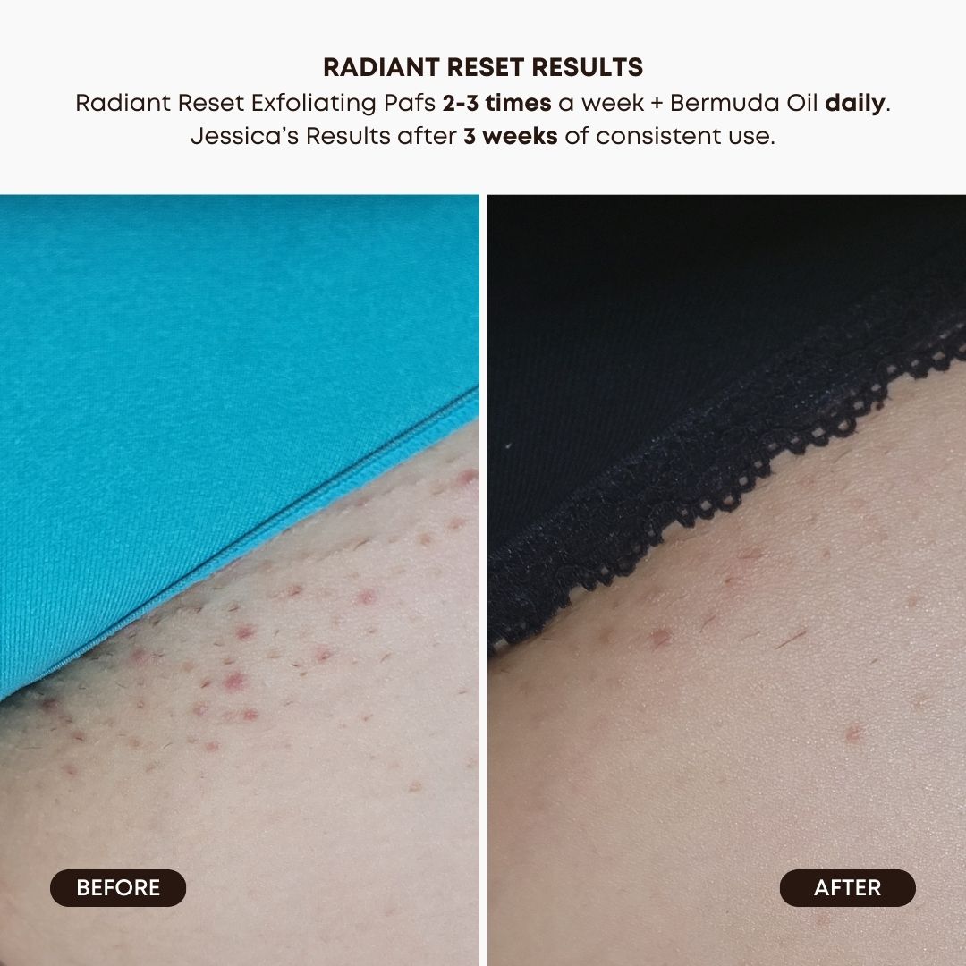 Radiant Reset Exfoliating Toner Pads Y1