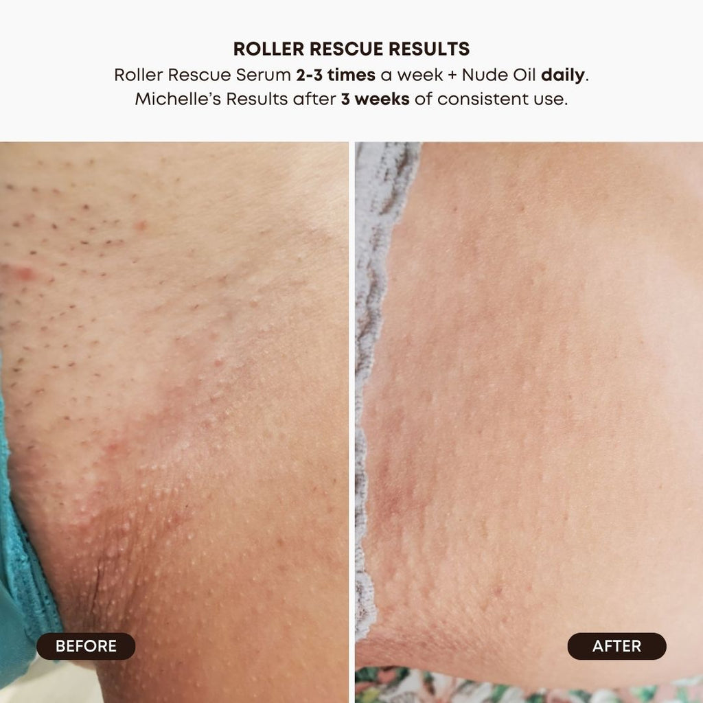 Roller Rescue Soothing Serum Q8